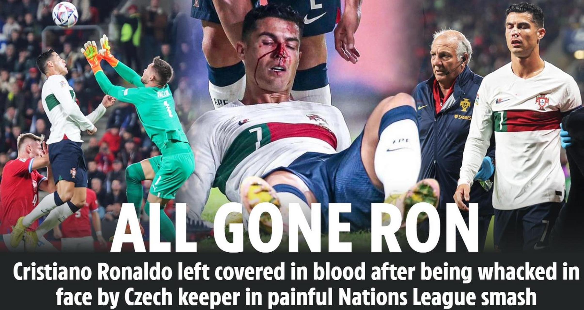 欧国联比赛:马赛惊险击败曼联 欧国联比赛:马赛惊险击败曼联